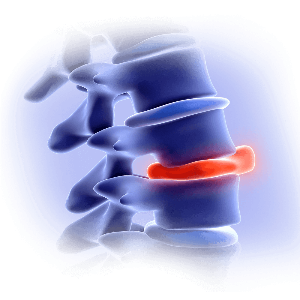 Hernia Surgery Healing